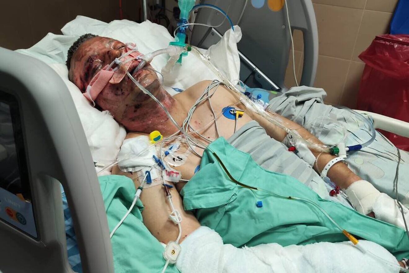 Kopylov im Krankenhaus, nachdem er durch eine ferngezündete Bombe im Gazastreifen verwundet wurde. Kredit: Mit freundlicher Genehmigung.